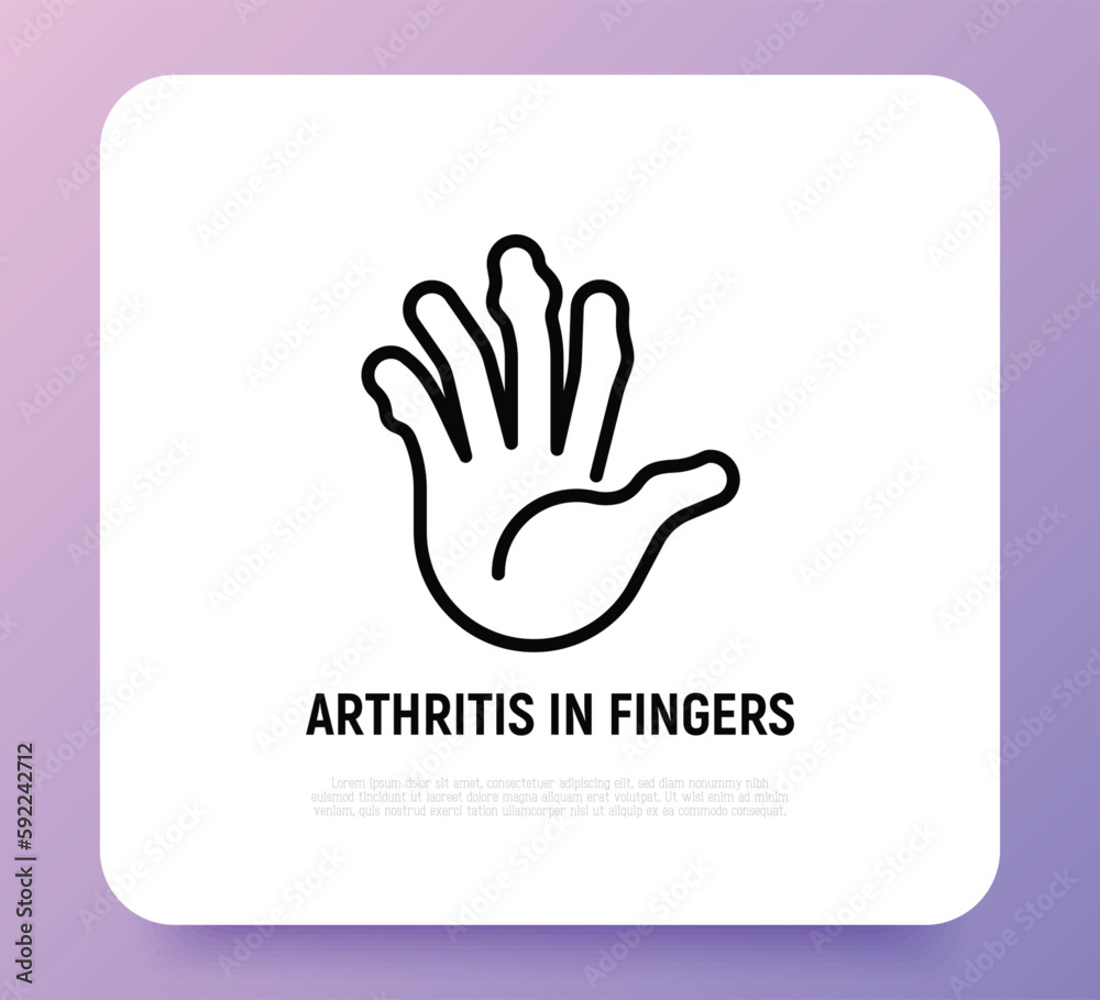 Arthritis in fingers thin line icon. Inflammation in joints. Osteoarthritis. Vector illustration. Arthritis in fingers thin line icon. Inflammation in joints. Osteoarthritis. Vector illustration.