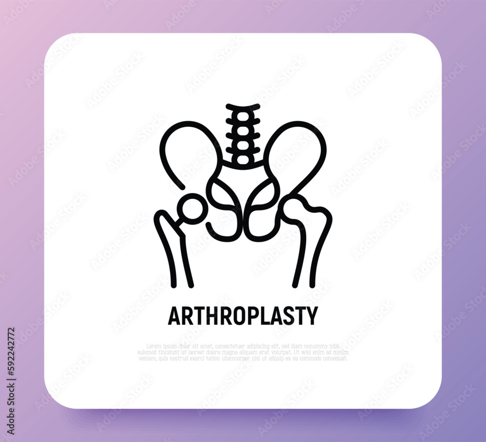 Arthroplasty thin line icon, artificial joint, surgical procedure to restore joint. Arthritis. Vector illustration.