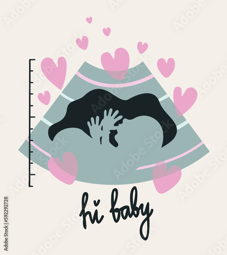 Prenatal ultrasound. Vector illustration with hearts and lettering isolated on light beige background.