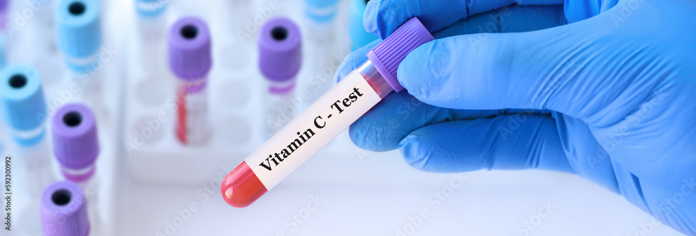 Naklejka premium Doctor holding a test blood sample tube with Vitamin С test on the background of medical test tubes with analyzes.Banner.