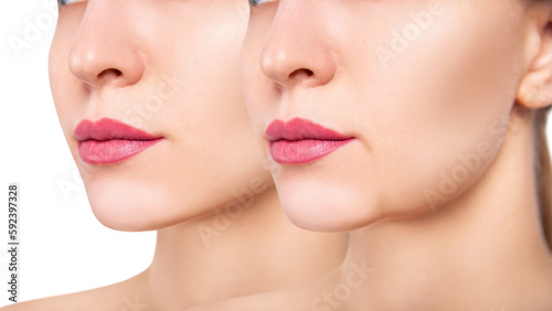 Chin of beautiful woman before and after rejuvenation.