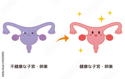 不健康な子宮・卵巣→健康な子宮・卵巣のイメージ