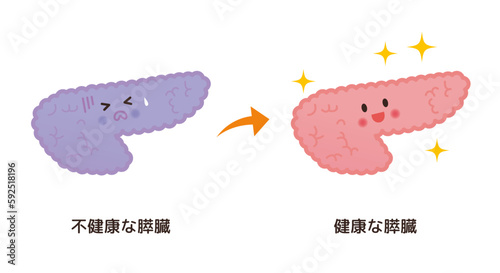 不健康な膵臓→健康な膵臓のイメージ