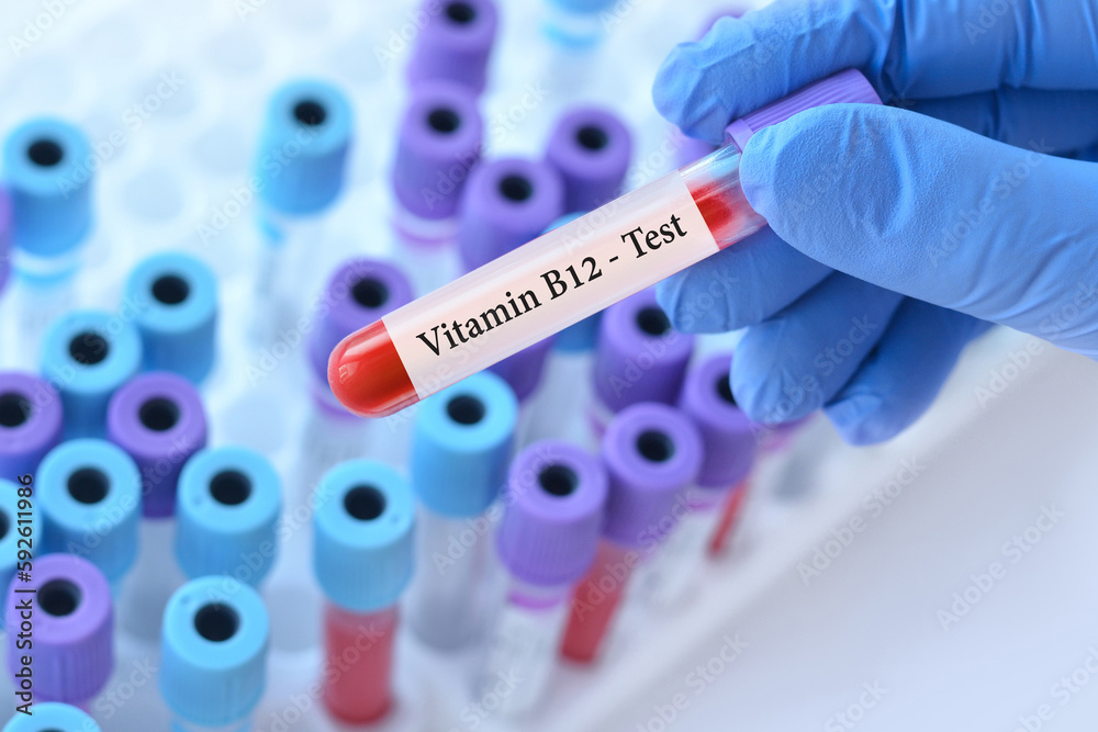 Doctor holding a test blood sample tube with Vitamin B12 test on the