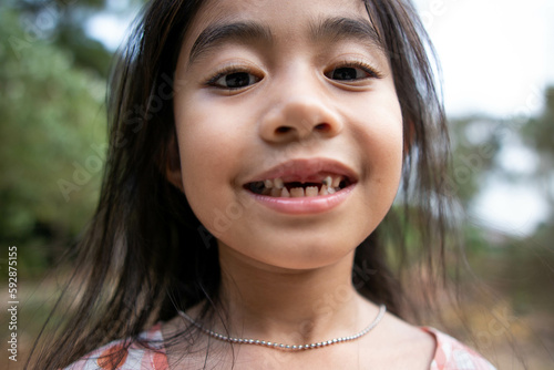 Cute asian girl missing front tooth