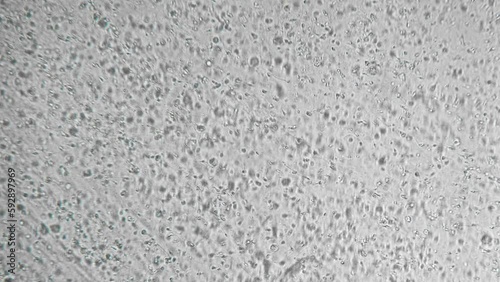 Slow motion active spermatozoa under the microscope. Sperm bank. reproductive function of man. The survival of all mankind