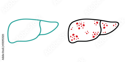 Healthy Liver and Liver disease minimalist lineart illustration. Chronic Inflammation of the internal organ: Liver cirrhosis, fibrosis, hepatitis, fatty liver or cancer concept Malignant neoplasm icon