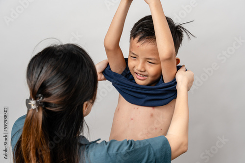 Φωτογραφία A mother is applying itching ointment to him 7 year old Asian boy suffering from chickenpox