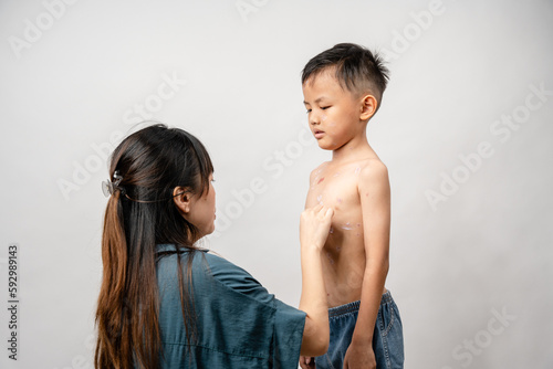 Φωτογραφία A mother is applying itching ointment to him 7 year old Asian boy suffering from chickenpox