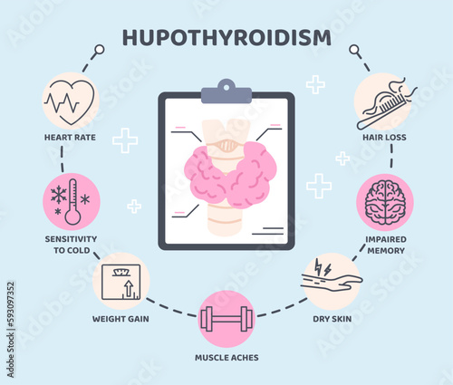 Thyroid infographic concept. Visualization of medical advice. Health care and medicine. Syndromes of hypothyroidism. Sensitivity to cold, muscles aches and hair loss. Cartoon flat vector illustration