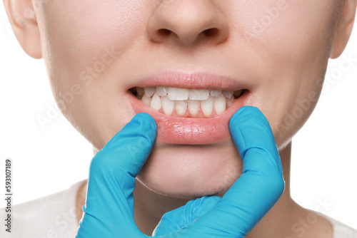 Doctor examining woman s gums on white background  closeup
