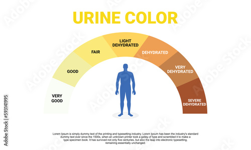 Illustration of urine color chart