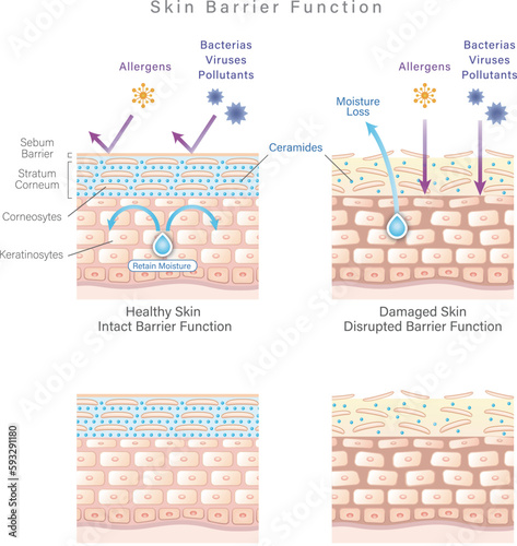 Skin anatomy/cross-section diagram explaining the skin barrier function difference between healthy skin and damaged skin.