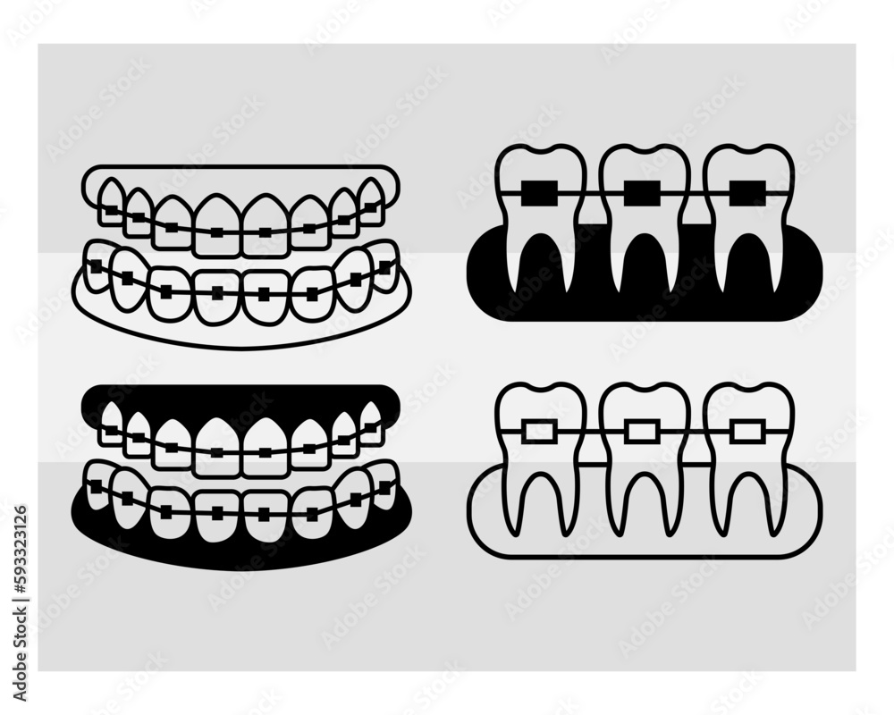 Fake Braces, Fake Braces Kit, Fake Braces Clip On, Braces Svg, Dental
