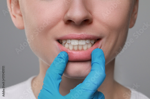 Doctor examining woman s gums on grey background  closeup