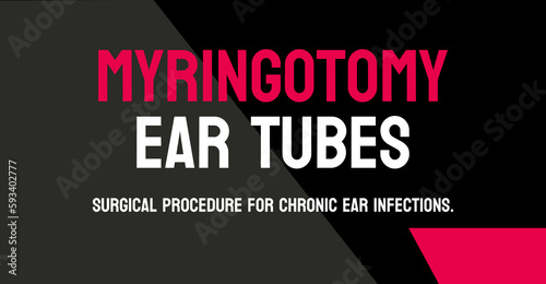 Myringotomy Ear Tubes - Surgical procedure to insert tubes in the ears