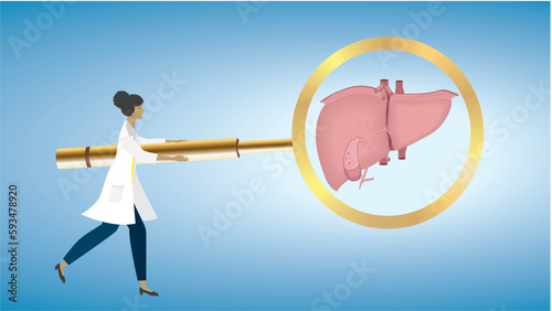 Woman, doctor with on big magnifying glass , focus, looking at liver, iecur. Liver cirrhosis, dysfunction. Dimension 16:9. Vector illustration.