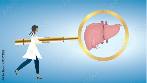 Woman, doctor with on big magnifying glass , focus, looking at liver, iecur. Liver cirrhosis, dysfunction. Dimension 16:9. Vector illustration.