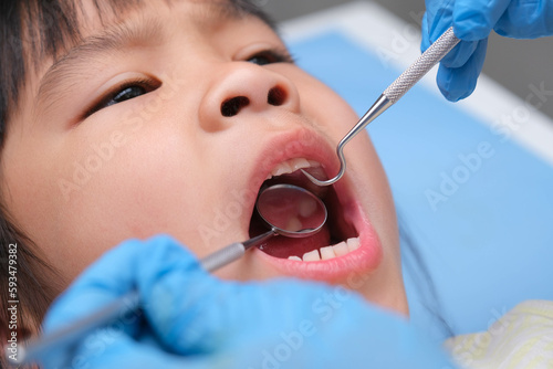Close-up in the oral cavity of a healthy child with beautiful white teeth. Young girl opens her mouth to reveal healthy teeth, hard and soft palate. Dental and oral health check