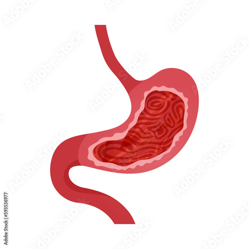 Gastritis Symptom Icon