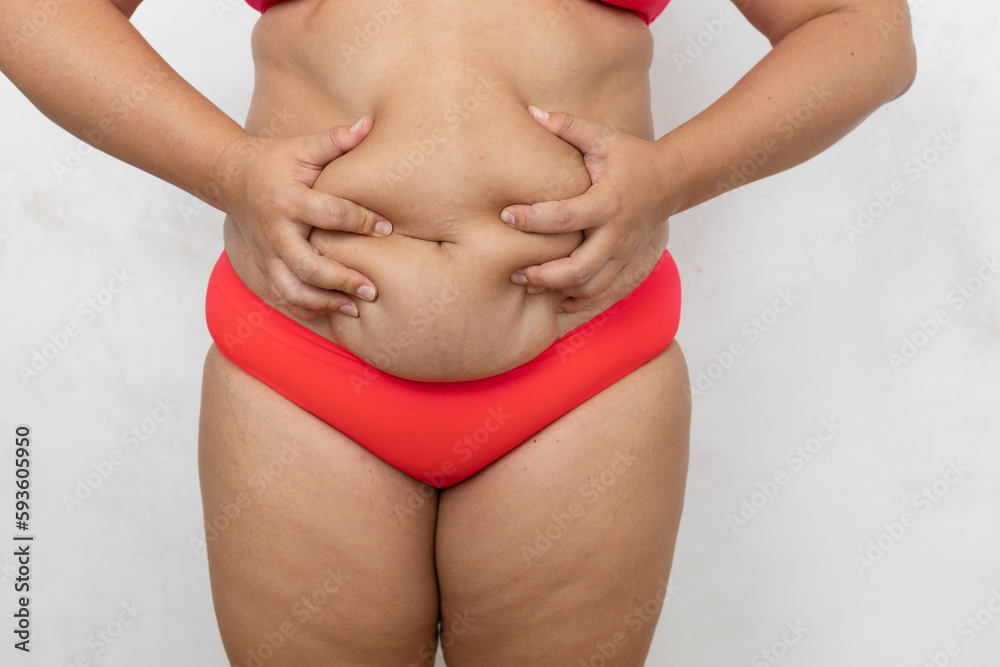 Cropped fat, adipose woman in red lingerie squeezing and showing dozed flab abdomen on white background. Need plastic surgery, abdominoplasty and liposuction. Superfluity of calories. Copy space