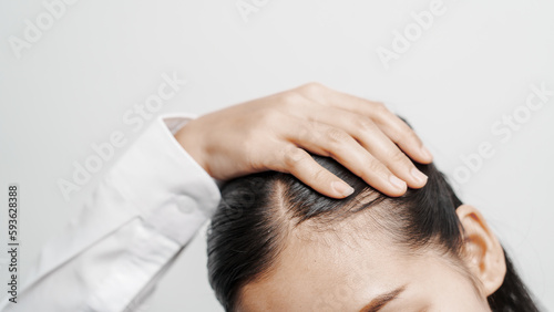 Close up young asian chinese woman with hair loss problem, dandruff and itchy scalp problems.