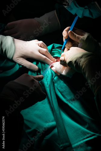 Close-up of a surgeon's hands making an incision in a patient's skin.
