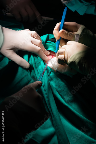 Close-up of a surgeon's hands making an incision in a patient's skin.