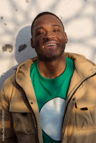 Young black man with vitiligo photo