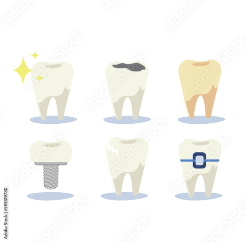 Dental health concept. set of teeth with different types of dental diseases  implant  caries  tartar  bridge. Flat cartoon Vector illustration
