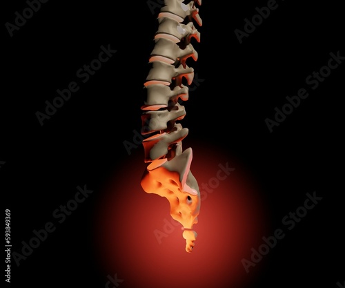 Isolated human's tailbone pain, called coccydynia 3d rendering photo