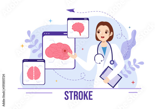 Human Brain Stroke Vector Illustration with Scientific Medical, Hemorrhage and Pain Point in Flat Cartoon Hand Drawn Landing Page Templates