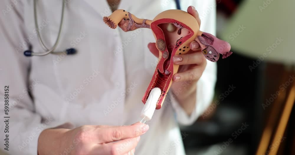 Hygienic tampons in uterus in hands of gynecologist. Gynecological