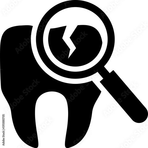 Cracked Tooth