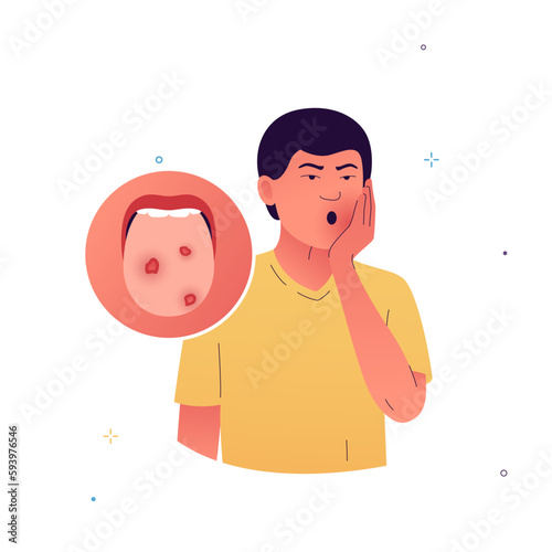 Vector illustration of a character with tongue ulcers. Non-healing wounds in the oral cavity. A man holds his face with his hand because of pain in his mouth. Symptoms of stomatitis, tuberculosis.