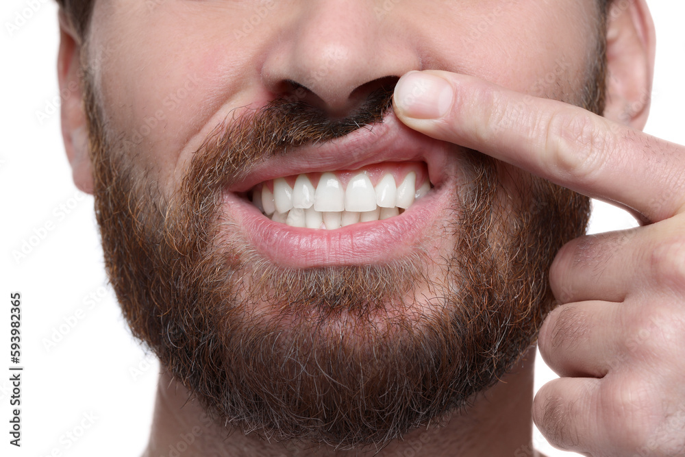 Man showing healthy gums on white background, closeup Man showing healthy gums on white background, closeup