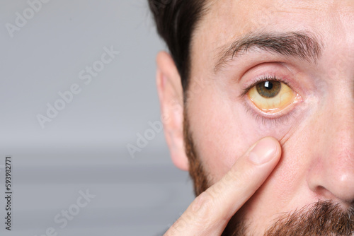 Photography Man with yellow eyes on blurred background, closeup