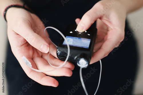 Woman holding her insulin pump in hands