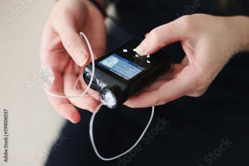 Woman holding her insulin pump in hands