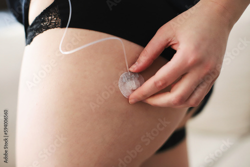 Woman connecting her insulin pump to the infusion set in her body