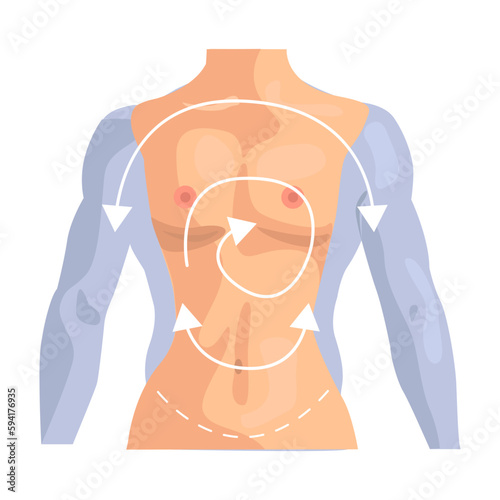 Sex-change operation illustration in color cartoon style. Editable vector graphic design.