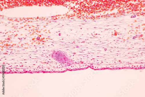 фотографія Anatomy and Histological Bone, Elastic cartilage human and Joint of human foetus under the microscope for education