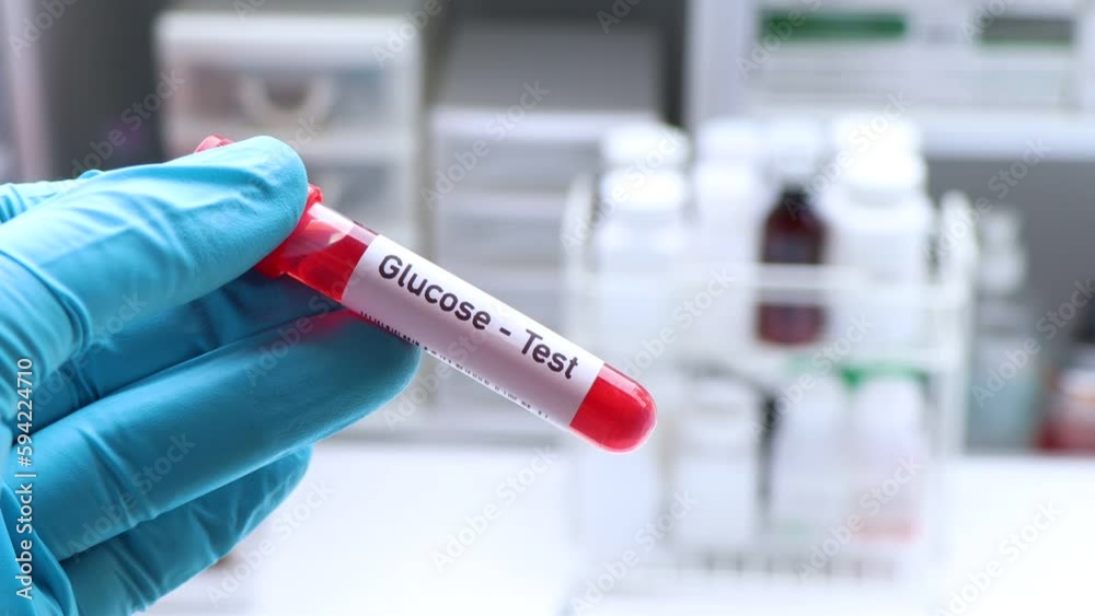 Glucose test to look for abnormalities from blood, blood sample to analyze in the laboratory, blood in test tube Glucose test to look for abnormalities from blood, blood sample to analyze in the laboratory, blood in test tube