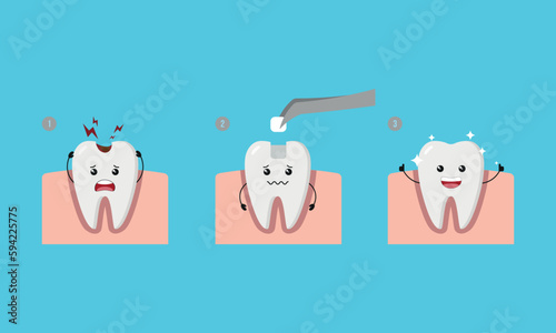 Dental Step of restoring cavity tooth by filling tooth illustration cartoon character vector design on blue background. Dental care concept. photo