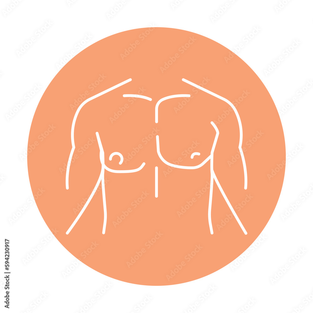 Breast gynecomastia color line icon. Human diseases. Breast gynecomastia color line icon. Human diseases.
