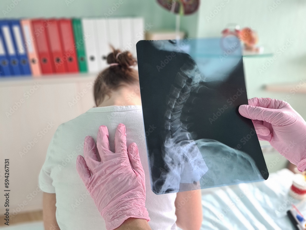 Pediatrician doctor examines x-ray of child spinal deformity - obrazy, fototapety, plakaty 