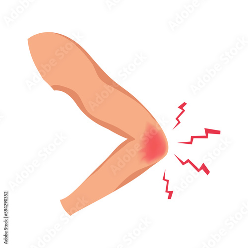 Elbow Injury Illustration