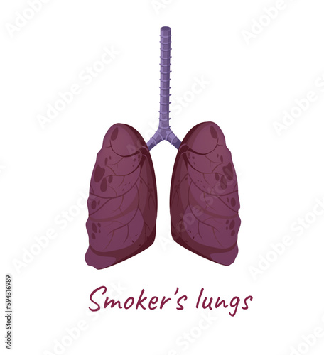 Concept Human anatomy organ smokers lungs. This illustration features a flat, vector design of the anatomy of the lungs of a smoker, depicted in a cartoon style. Vector illustration.
