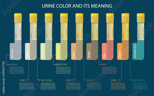 An Infographic meaning of urine color.sample tubes with the different possible colors.
