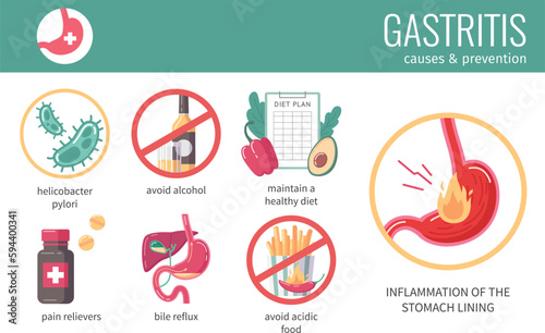 GERD Flat Infographics
